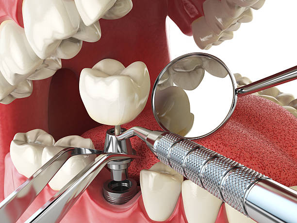 Best Emergency Dentist for Knocked-Out Tooth in Swissvale, PA